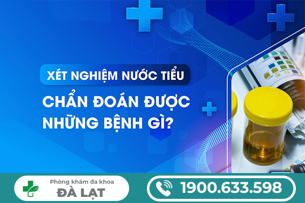 Hình ảnh minh họa